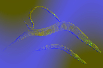 FDA-approved high blood pressure drug extends life span in roundworms