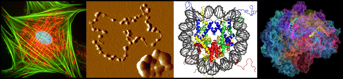A panel of 4 pictures depicting a stained cell, condensed chromatin, and 2 illustrations of DNA with associated proteins