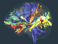Recent advancements in neuroimaging now make it possible for researchers to map and understand how information between different areas of the brain is relayed.