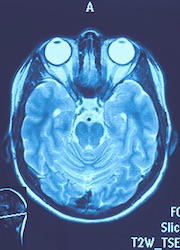 At UT Southwestern, rapid progress in brain imaging is transforming the field of neuroscience research and clinical care.