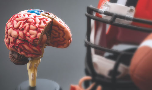 Dr. Munro Cullum and sports concussions