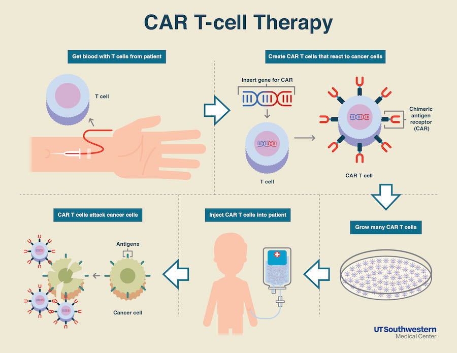 How CAR-T therapy works