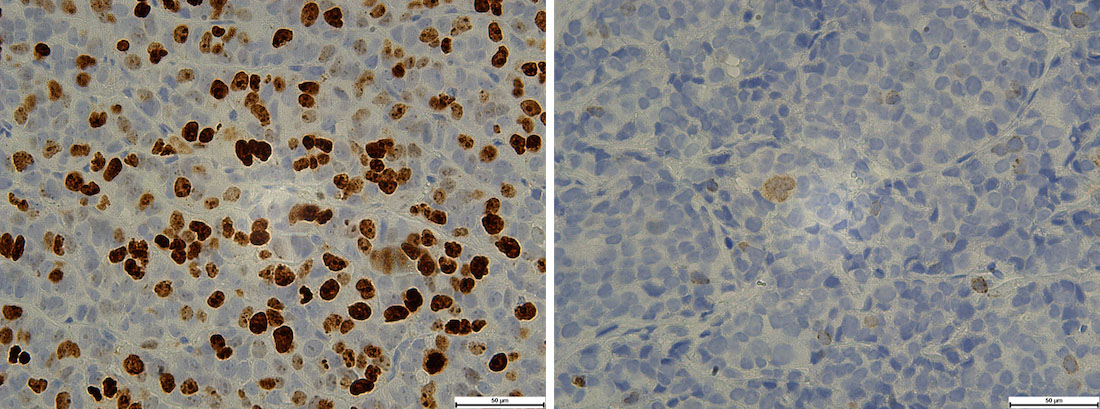 These images show staining of cell proliferation marker