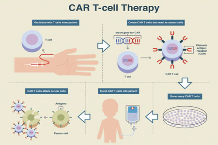 Map of CAR-T cell therapy process