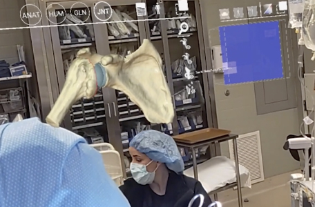 An image of the shoulder joint floats above the surgical team using augmented reality