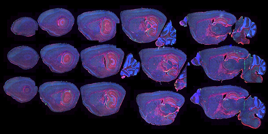 mouse brain slices
