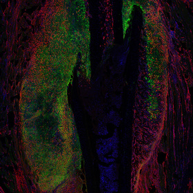 Researchers find that different stem cells are responsible for the repair of different kinds of bone injuries