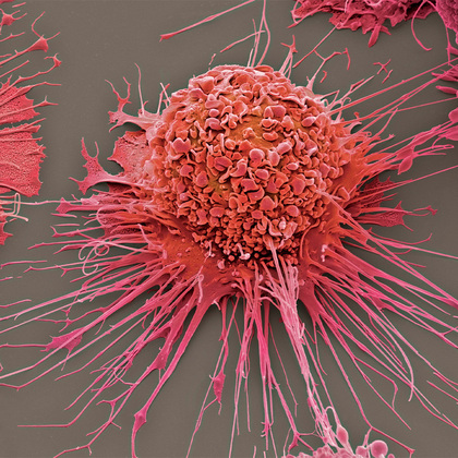 Study reveals molecular ‘switch’ that turns on inflammation in obesity