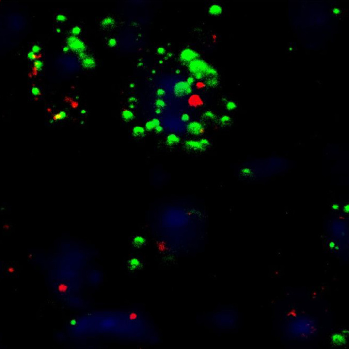 neurons-thumb.jpg