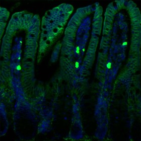 UTSW scientists reveal how vitamin A enters immune cells in the gut