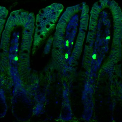 UTSW scientists reveal how vitamin A enters immune cells in the gut