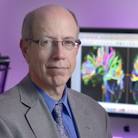 UTSW researchers find increased risk of mild cognitive impairment following traumatic brain injury