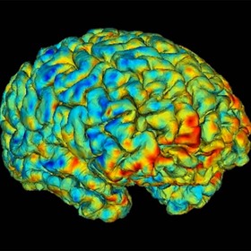 UTSW-led research identifies new imaging biomarkers that predict antidepressant response