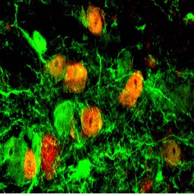 Strict lineage tracing crucial to nerve cell regeneration research, study says
