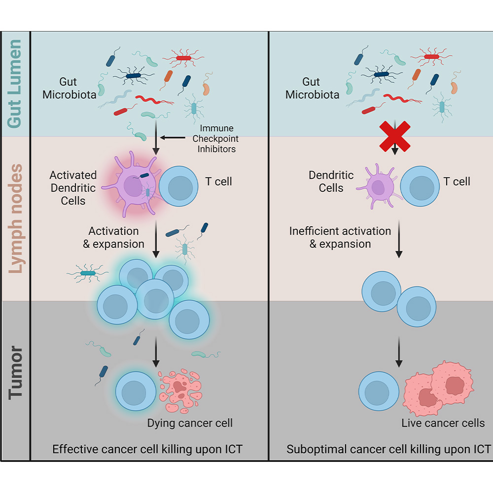 Healthy gut bacteria can help fight cancer in other parts of the body, UTSW researchers find: Newsroom