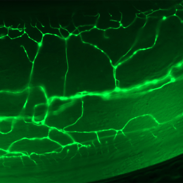nerve-cell-thumb.jpg