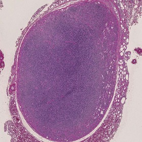 UTSW study: RNA exosome key for B cell development