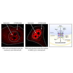 Targeting Nsp1 protein could be a pathway for COVID-19 therapy