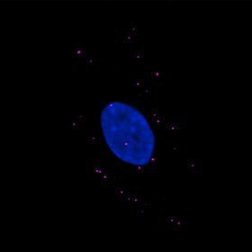 Phase separation found in immune response within cells