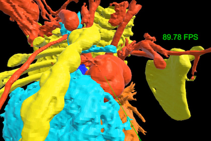 Looking inside a tiny heart to fix a big problem