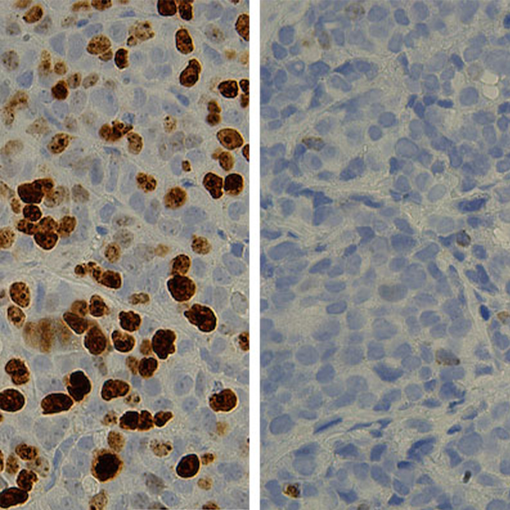 cell-proliferation-marker-thumbv2.jpg