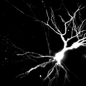 dendrites-thumb.jpg