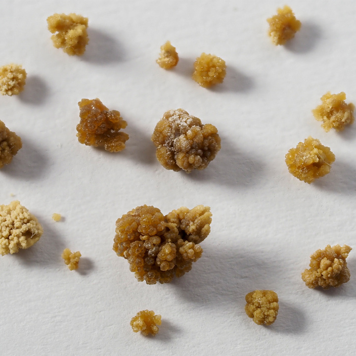 kidney-stones-thumb.jpg