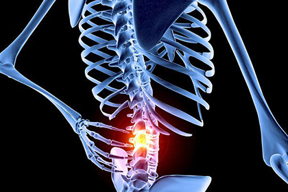 ACP Recommends First Trying Nondrug Therapies for Back Pain