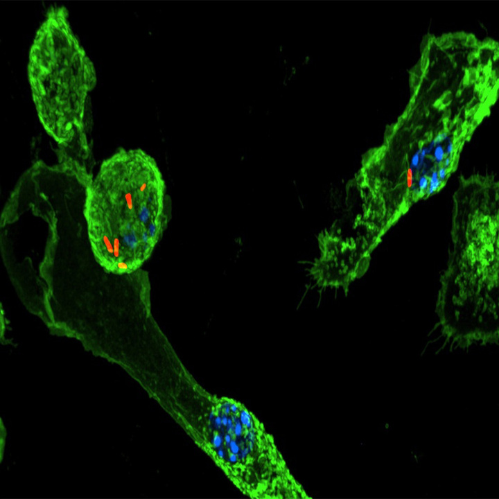 immunofluorescence-microscopy-macrophages-thumb.jpg