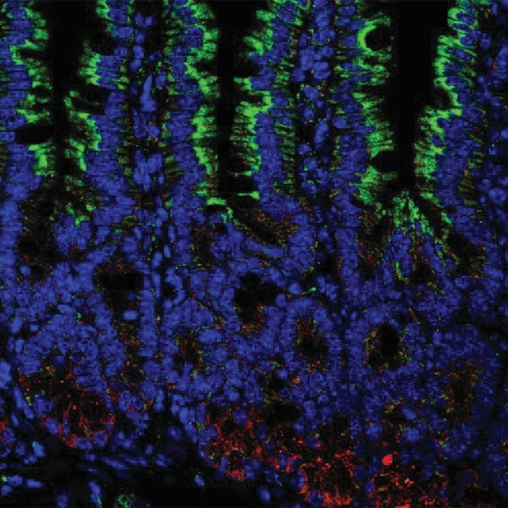 immunofluorescence-microscopy-thumb.jpg