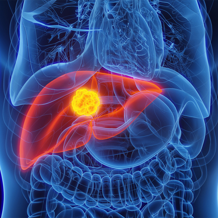 liver-cancer-thumb.jpg