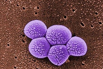 Study: Superbug MRSA infections less costly, but still deadly