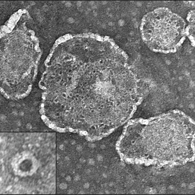 How human cells and pathogenic <em>shigella</em> engage in battle