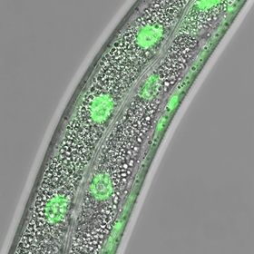 Surveillance pathway tells cells when they run low on lipids