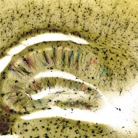mouse-brain-brightfield-microscope-thumb.jpg