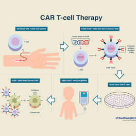 New CAR T-cell therapy extends remission in heavily relapsed multiple myeloma patients