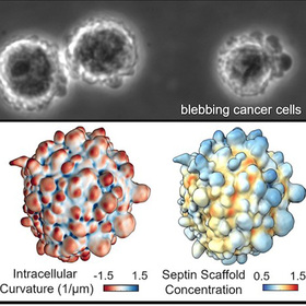 UT Southwestern study: Cell membrane ‘blebs’ could hold new targets for anti-cancer drugs