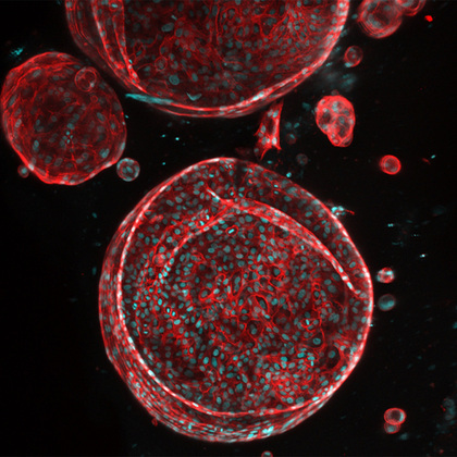 UTSW receives ARPA-H award to create functioning artificial liver