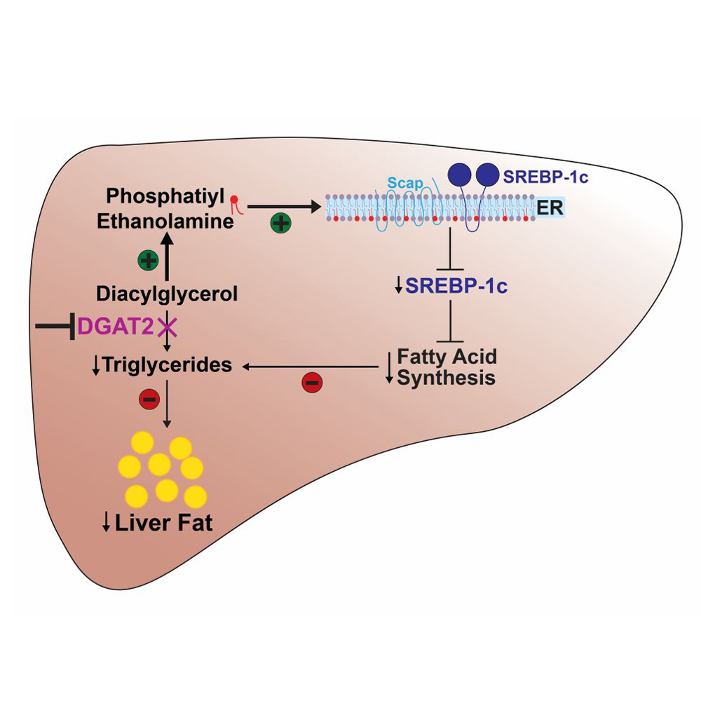 How an experimental drug reverses fatty liver disease