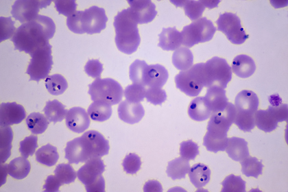 Ticking time bomb: Malaria parasite has its own inherent clock