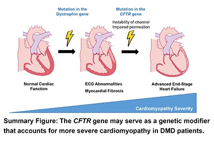 Genetic mutation could worsen heart function in Duchenne muscular dystrophy patients