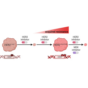 New drug combo could treat some resistant breast cancers