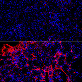 UT Southwestern study shows glucagon is key for kidney health