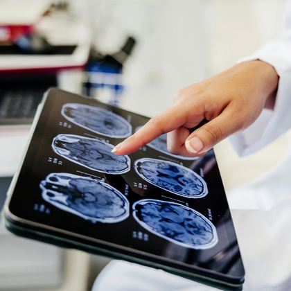 Adult survivors of childhood cancer at higher risk for meningiomas