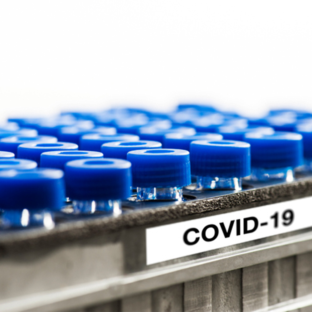 UTSW researchers develop rapid COVID-19 test to identify variants in hours