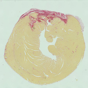 Gene editing halts damage in mice after heart attacks in UT Southwestern study