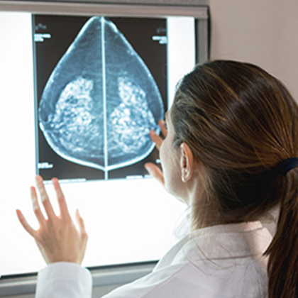 Response to hormone therapy predicts radiation resistance in ER+ breast cancer