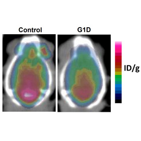 UTSW scientists identify brain circuit that triggers rare, blood sugar-dependent epilepsy