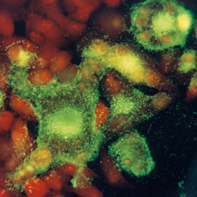 UTSW researchers take new approach to fight viral infections