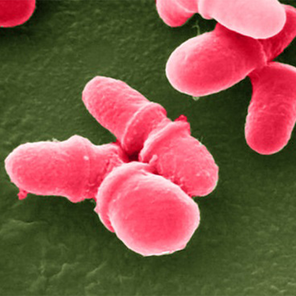 Gut microbes may lead to therapies for mental illness, UTSW researcher reports